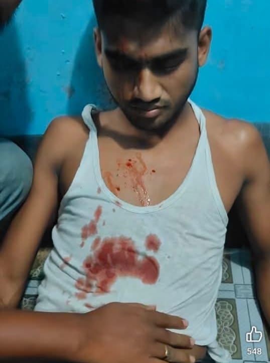 যুব অধিকার নেতা তানজিলের ওপর হামলার নিন্দা, দোষীদের গ্রেপ্তারের দাবি ঢাকা জেলা উত্তর যুব অধিকার পরিষদের