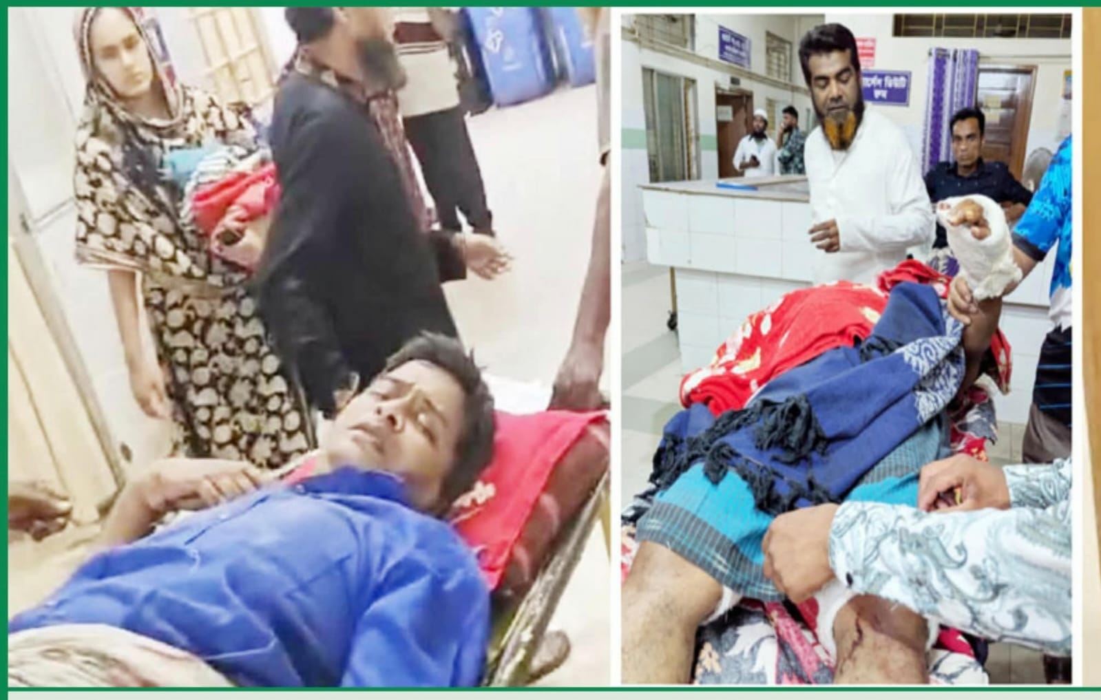 চুরি মামলা তুলে নেয়ায় সাংবাদিক কুপিয়ে জখম আঙুল বিচ্ছিন্ন