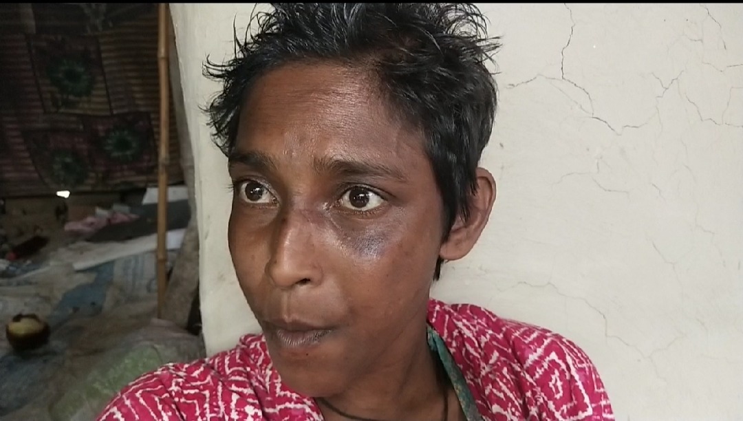 তানোরে প্রতিবন্ধী নারীকে ধর্ষণের অভিযোগ অভিযুক্ত আপন চাচা, এলাকায় তীব্র চাঞ্চল্য