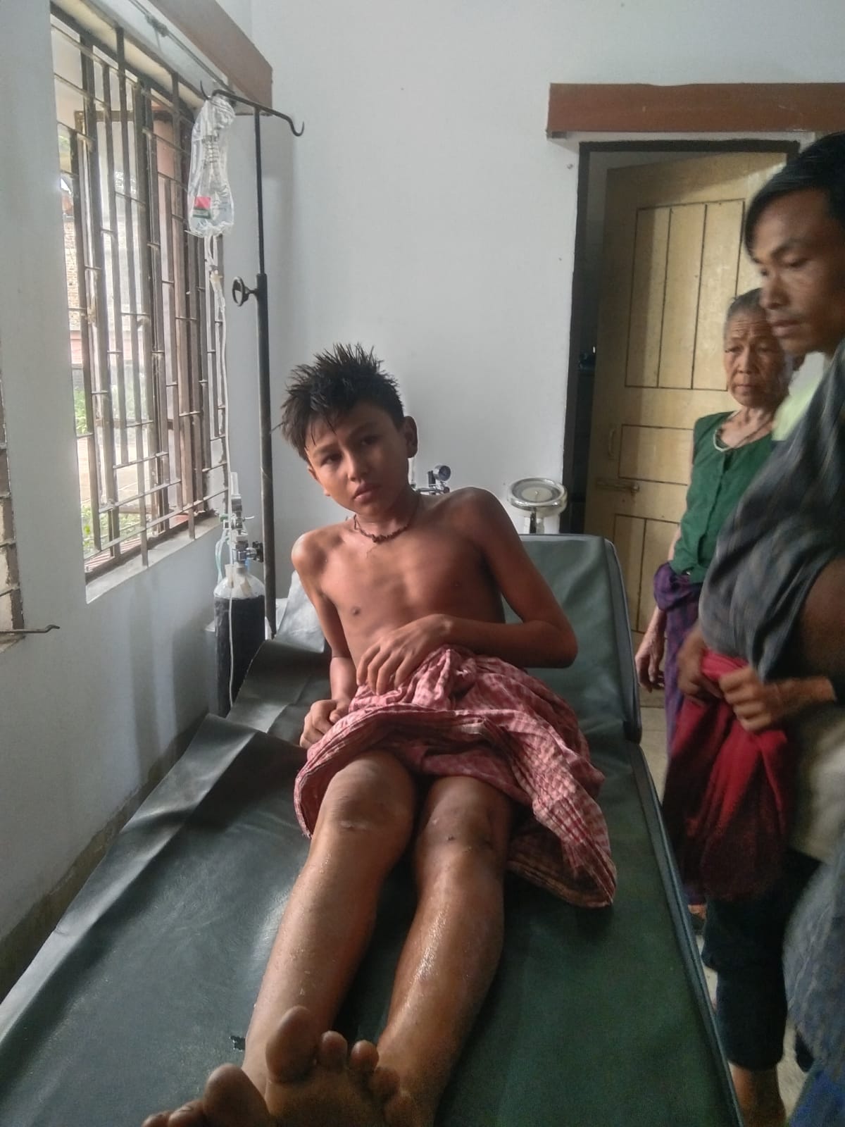 আলীকদম বাস টার্মিনাল এলাকায় টমটমের ধাক্কায় ১৩ বছরের শিশু গুরুতর আহত