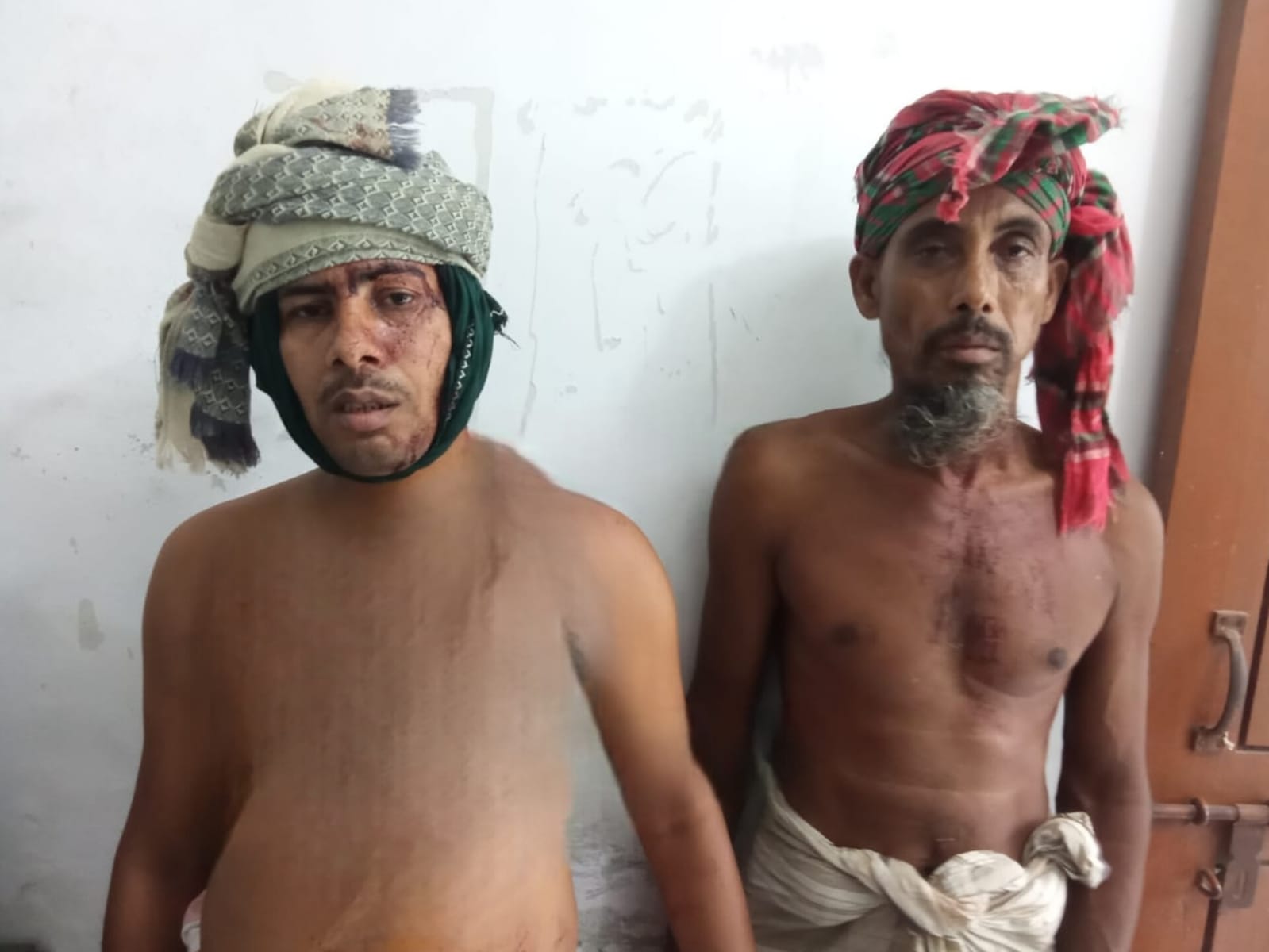 তানোরে জমি নিয়ে সংঘর্ষের অভিযোগ লোহার সাবলের আঘাতে দু’জন আহত, পাঁচজনের বিরুদ্ধে থানায় অভিযোগ