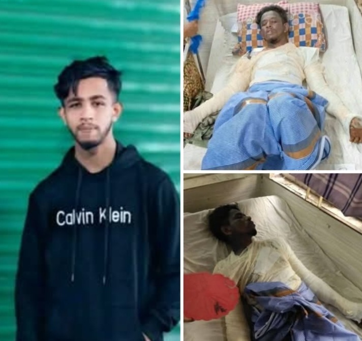 অবৈধ গ্যাস ক্রস-রিফিলের বলি ইমন: